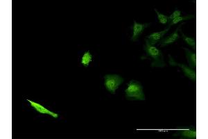 Immunofluorescence of monoclonal antibody to SEC13 on HeLa cell. (SEC13 Antikörper  (AA 226-324))