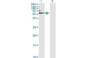 Western Blot analysis of ALB expression in transfected 293T cell line by ALB monoclonal antibody (M01), clone 1G12-1B3.