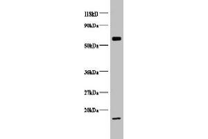 Western blot All lanes: COX5B antibody at 2 μg/mL + EC109 whole cell lysate Secondary Goat polyclonal to rabbit IgG at 1/15000 dilution Predicted band size: 14 kDa Observed band size: 14, 65 kDa (COX5B Antikörper  (AA 32-129))