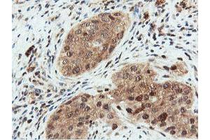 Image no. 8 for anti-Dual Specificity Phosphatase 23 (DUSP23) antibody (ABIN1497930) (DUSP23 Antikörper)