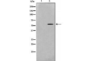 Western blot analysis of Src expression in 293 whole cell lysates,The lane on the left is treated with the antigen-specific peptide.