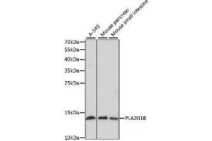 Western blot analysis of extracts of various cell lines using PLA2G1B Polyclonal Antibody at dilution of 1:1000. (PLA2G1B Antikörper)