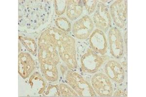 Immunohistochemistry of paraffin-embedded human kidney tissue using ABIN7171149 at dilution of 1:100 (SNAP29 Antikörper  (AA 1-258))