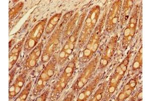 Immunohistochemistry of paraffin-embedded human small intestine tissue using ABIN7160177 at dilution of 1:100 (SLC16A9 Antikörper  (AA 185-304))