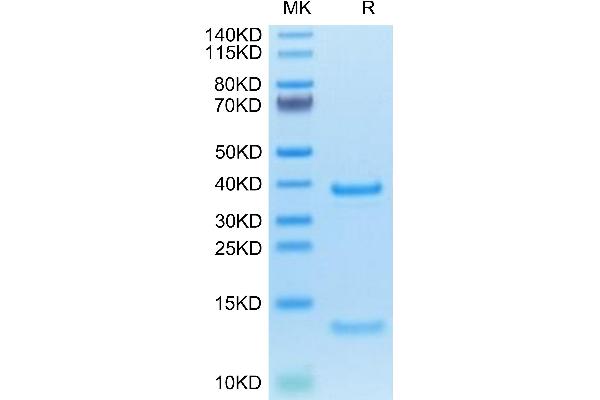 FcRn Protein (AA 24-297) (His tag)