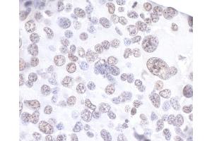 Immunohistochemistry (IHC) image for anti-Apoptosis Inhibitor 5 (API5) (AA 1-50) antibody (ABIN7453657) (Apoptosis Inhibitor 5 Antikörper  (AA 1-50))