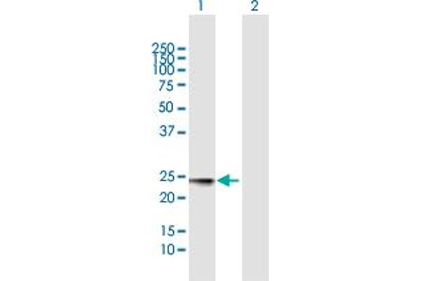 MED18 Antikörper  (AA 1-208)