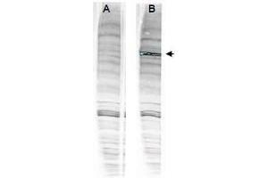 Image no. 2 for anti-Werner Helicase Interacting Protein 1 (WRNIP1) (Internal Region) antibody (ABIN401271) (WRNIP1 Antikörper  (Internal Region))