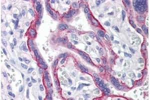 Human Placenta (formalin-fixed, paraffin-embedded) stained with LRRC1 antibody ABIN214508 at 5 ug/ml followed by biotinylated goat anti-rabbit IgG secondary antibody ABIN481713, alkaline phosphatase-streptavidin and chromogen. (LRRC1 Antikörper  (C-Term))