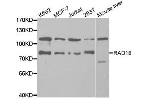 Western Blotting (WB) image for anti-E3 ubiquitin-protein ligase RAD18 (RAD18) antibody (ABIN1876568) (RAD18 Antikörper)