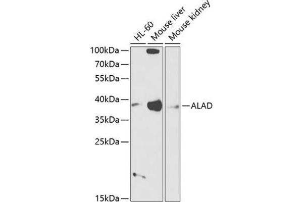 ALAD Antikörper  (AA 1-330)