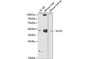 Western blot analysis of extracts of various cell lines, using ALAD antibody (ABIN6129891, ABIN6136749, ABIN6136751 and ABIN6216012) at 1:1000 dilution.