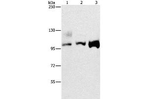 Western Blot analysis of A431, 293T and hela cell using ASCC2 Polyclonal Antibody at dilution of 1:500 (ASCC2 Antikörper)