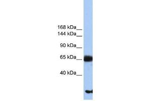 PIGO antibody used at 1 ug/ml to detect target protein. (IGLL1 Antikörper  (N-Term))