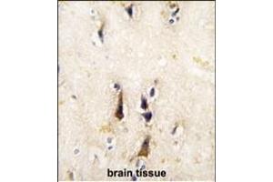 Formalin-fixed and paraffin-embedded human brain tissue reacted with BACE1 antibody (N-term), which was peroxidase-conjugated to the secondary antibody, followed by DAB staining. (BACE1 Antikörper  (N-Term))