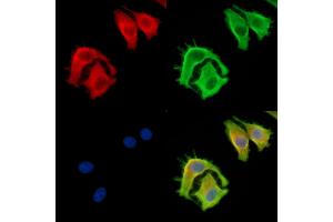 ABIN7095009 and ABIN7099065 staining HepG2 cells by IF/ICC.