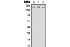 Western blot analysis of Nav1. (SCN8A Antikörper  (N-Term))