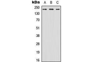 Western blot analysis of Nav1. (SCN8A Antikörper  (N-Term))