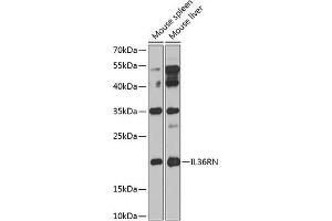 Western blot analysis of extracts of various cell lines, using IL36RN antibody (ABIN6132859, ABIN6142394, ABIN6142395 and ABIN6224229) at 1:1000 dilution. (FIL1d Antikörper  (AA 1-155))