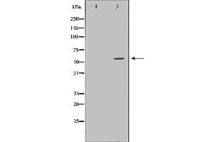 Western blot analysis of Hela whole cell lysates, using GALNS Antibody. (GALNS Antikörper  (Internal Region))