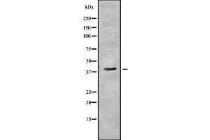 Western blot analysis of PYGO2 using HuvEc whole cell lysates (PYGO2 Antikörper  (N-Term))