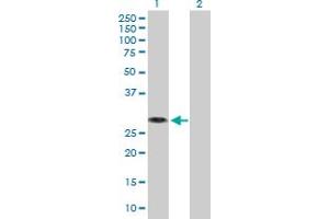 Western Blot analysis of MED6 expression in transfected 293T cell line by MED6 MaxPab polyclonal antibody. (MED6 Antikörper  (AA 1-246))