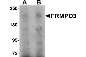 Western Blotting (WB) image for anti-FERM and PDZ Domain Containing 3 (FRMPD3) (Middle Region) antibody (ABIN1030934) (FRMPD3 Antikörper  (Middle Region))