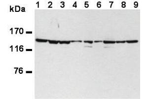 Western Blotting (WB) image for anti-Splicing Factor 3b, Subunit 1, 155kDa (SF3B1) (AA 98-198) antibody (ABIN1449241) (SF3B1 Antikörper  (AA 98-198))