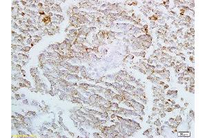 Formalin-fixed and paraffin embedded rat lung labeled with Anti-Claudin-4 Polyclonal Antibody, Unconjugated  at 1:200 followed by conjugation to the secondary antibody and DAB staining (Claudin 4 Antikörper  (AA 21-120))