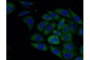 IF analysis of PC-3 cells, using SLN antibody (1/50 dilution) and AF488-conjugated Goat anti-Rabbit IgG (H+L). (SLN Antikörper)
