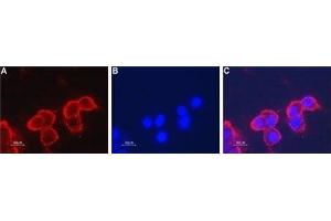Colocalization of CaV1.