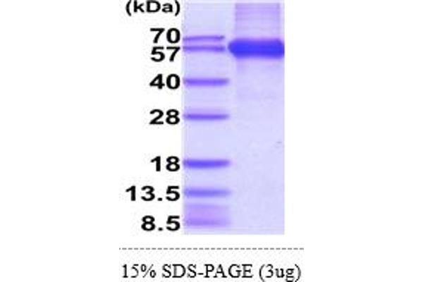 Retinoic Acid Early Transcript 1E (RAET1E) (AA 31-225) protein (hIgG-His-tag)