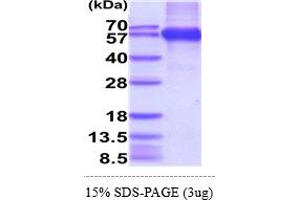 SDS-PAGE (SDS) image for Retinoic Acid Early Transcript 1E (RAET1E) (AA 31-225) protein (hIgG-His-tag) (ABIN5854981)