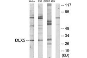 Western blot analysis of extracts from HeLa/293/COLO205 cells, using DLX5 Antibody. (DLX5 Antikörper  (AA 91-140))
