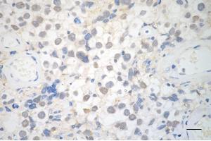Immunohistochemistry was performed on paraffin-embedded human seminoma using RAVER2 antibody (ABIN7800211), 1:200).