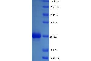 SDS-PAGE (SDS) image for Ribose 5-Phosphate Isomerase A (RPIA) (AA 1-219), (full length) protein (ABIN5714306)