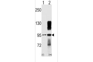 Western blot analysis of TYRO10 using rabbit polyclonal TYRO10 Antibody using 293 cell lysates (2 ug/lane) either nontransfected (Lane 1) or transiently transfected with the DDR2 gene (Lane 2). (DDR2 Antikörper)