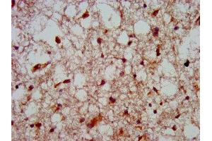 IHC image of ABIN7155717 diluted at 1:800 and staining in paraffin-embedded human brain tissue performed on a Leica BondTM system. (HOXA4 Antikörper  (AA 23-173))