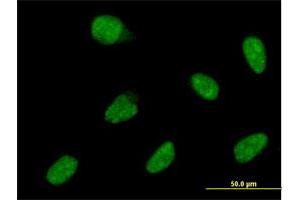 Immunofluorescence of monoclonal antibody to ATOH1 on HeLa cell. (ATOH1 Antikörper  (AA 266-354))