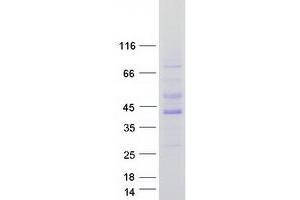 Western Blotting (WB) image for Protein Kinase, AMP-Activated, beta 1 Non-Catalytic Subunit (PRKAB1) protein (Myc-DYKDDDDK Tag) (ABIN2714672)