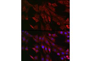 Immunofluorescence (IF) image for anti-Family with Sequence Similarity 82, Member A2 (FAM82A2) (AA 171-470) antibody (ABIN6146979)