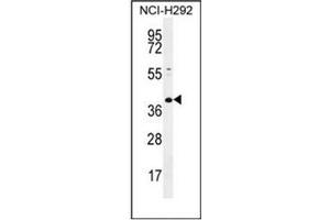 Western blot analysis of KCTD2 Antibody (C-term) in NCI-H292 cell line lysates (35ug/lane). (KCTD2 Antikörper  (C-Term))