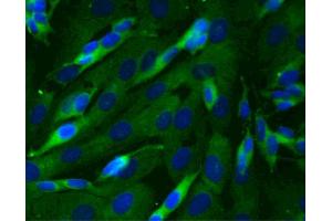 Immunofluorescent staining of SK-N-SH cells (Human neuroblastoma, ATCC HTB-11) (right). (Dynactin 1 Antikörper  (AA 3-202))