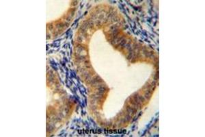 AHCY Antibody (N-term) immunohistochemistry analysis in formalin fixed and paraffin embedded human uterus tissue followed by peroxidase conjugation of the secondary antibody and DAB staining. (AHCY Antikörper  (N-Term))