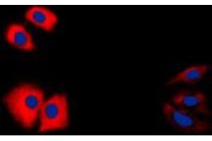 Immunofluorescent analysis of Caspase 1 p10 staining in HeLa cells. (Caspase 1 (p10) Antikörper  (C-Term))