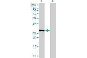 Western Blot analysis of BCAP31 expression in transfected 293T cell line by BCAP31 MaxPab polyclonal antibody. (BCAP31 Antikörper  (AA 1-246))