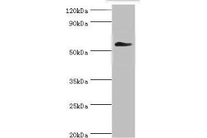Western blot All lanes: T-complex protein 1 subunit gamma antibody at 12 μg/mL + Mouse brain tissue Secondary Goat polyclonal to rabbit IgG at 1/10000 dilution Predicted band size: 61, 57 kDa Observed band size: 61 kDa (CCT3 Antikörper  (AA 1-300))