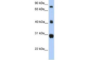 FIBCD1 antibody used at 1 ug/ml to detect target protein. (FIBCD1 Antikörper  (C-Term))