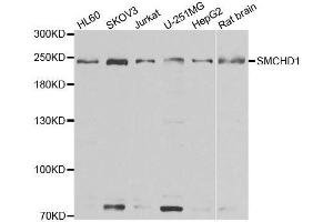 Western blot analysis of extracts of various cell lines, using SMCHD1 antibody. (SMCHD1 Antikörper  (AA 1756-2005))