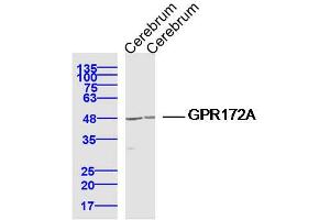 Lane 1: Cerebrum lysates Lane 2: Cerebrum lysates probed with GPR172A Polyclonal Antibody, Unconjugated  at 1:300 dilution and 4˚C overnight incubation. (GPR172A Antikörper  (AA 101-200))